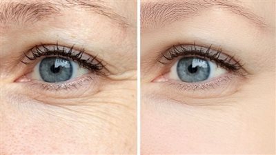 تقوية البصر: كيفية الحفاظ على صحة العين والوقاية من المشاكل البصرية