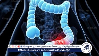 أفضل 7 أطعمة تساعد على تقليل أعراض القولون العصبى 