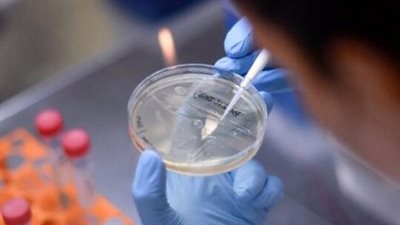 لا وجود لعلاج محدد.. ارتفاع حالات الإصابة بـ 