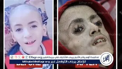 مأساة الطفل يزن.. الجوع يودي بحياة الأبرياء في قطاع غزة