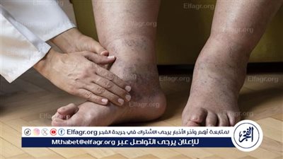  فهم مرض القدم السكري وكيفية الوقاية والعلاج
