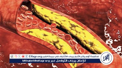 طرق فعّالة لتنظيف الشرايين والأوعية لمرضى الكوليسترول