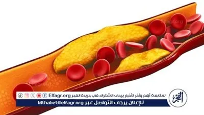 هكذا تحذر منظمة صحية بألمانيا: الدهون المتحولة تؤدي لمخاطر ارتفاع الكولسترول 