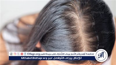 تعرف على أسباب تساقط الشعر.. والوقاية منه