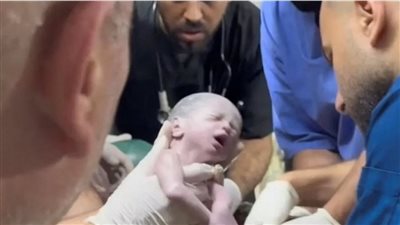 رفح تحت القصف..استخراج طفلة من رحم فلسطينية قتلت في غارة إسرائيلية 