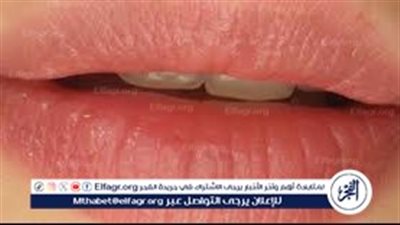 وصفة مذهلة هتخلي شفايفك مرايا من أول استعمال