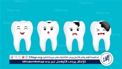 تعرف على أسباب تسوس الأسنان وكيفية الوقاية منه