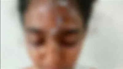 تصل للحبس والفصل من المهنة.. قانوني يوضح عقوبة المتوقعة لمعلمة ألقت مياه مغلية علي تلميذة داخل مدرسة