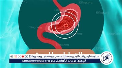 أسباب التهاب المعدة وكيفية الوقاية منها