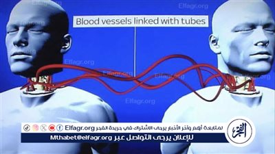نظام زراعة الرأس: الابتكار الطبي الذي يفتح آفاقًا جديدة للعلاج