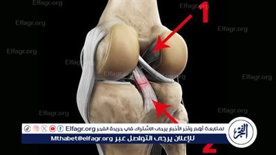  الرباط الصليبي الأمامي.. ما هو وكيف يمكن علاجه دون جراحة؟