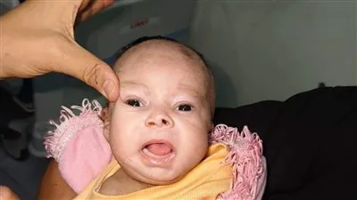 جراحة نادرة.. فريق طبي ينجح في استئصال ورم وزنه 2 كيلو لطفلة بمستشفى أحمد ماهر التعليمي