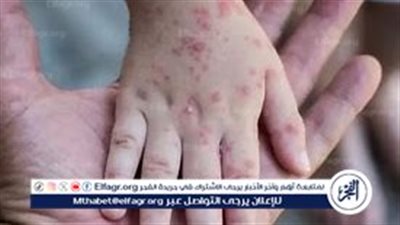 إعلان حالة طوارئ صحية دولية بشأن 