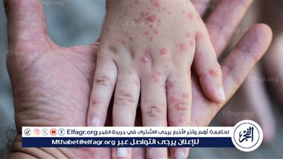 استشاري مناعة: الخريف موسم العدوى الفيروسية ولقاح الأنفلونزا ضروري قبل الشتاء