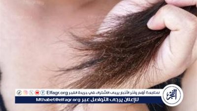 الشعر المتقصف: أسبابه وأفضل الطرق لعلاجه