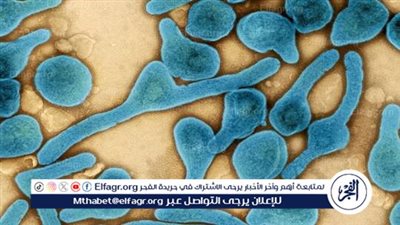 دولة إفريقية تعلن وفاة 8 أشخاص بفيروس خطير