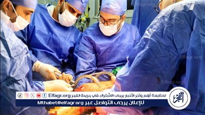 استمرت 4 ساعات..نجاح جراحة عظام ذات مهارة عالية بمستشفى أجا بالدقهلية