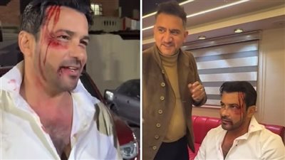 مسلسلات رمضان 2025.. محمد رجب يتعرض لحادث بمسلسل 