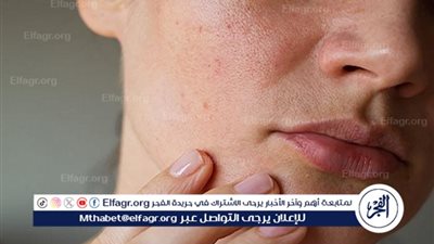 روتين العناية بالبشرة العادية في فصل الشتاء