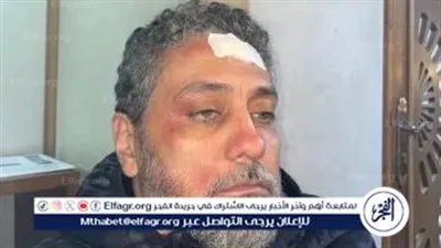 حادثة القدر لتامر فرج في مسلسل 