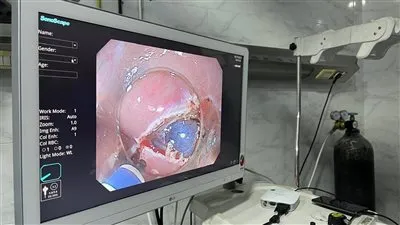 «الصحة» تعلن نجاح مستشفى منيا القمح في إجراء تدخلات متطورة بتقنية الفراغ الثالث