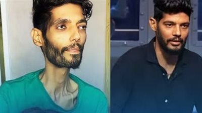 عاجل- حالته حرجة جدًا: كل ما تريد معرفته عن حالة إبراهيم شيكا لاعب الزمالك السابق