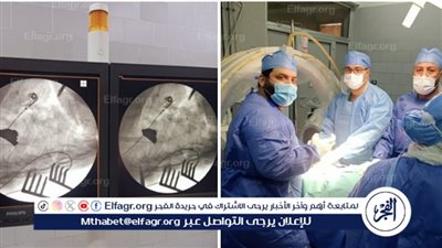 استمرت 4 ساعات.. نجاح جراحة دقيقة لاستخراج شظية بالعمود الفقرى لمريض بمستشفى أجا 