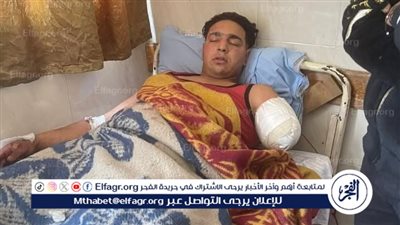 بعد مهاجمته من الأسد.. بتر ذراع عامل في سيرك بطنطا