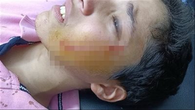 إحالة طالب للمحاكمة بعد اعتدائه على زميله أمام المدرسة