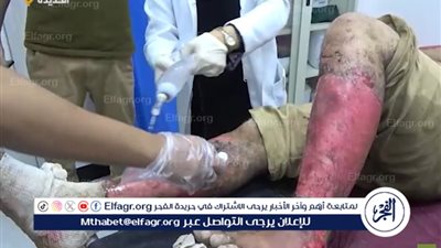 ارتفاع حصيلة ضحايا الغارات الأمريكية على منشأة رأس عيسى النفطية في اليمن