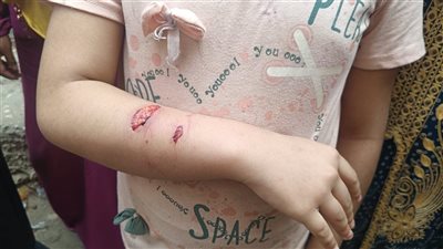 كلب ضال يعقر 7 أطفال بحى الصوفى بالفيوم