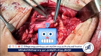 مدكور يشيد بجهود الفريق الطبى بمستشفى أجا في إنقاذ شاب من إصابة قاتلة بالرقبة