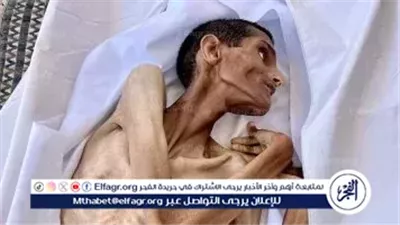 وفاة شاب فلسطيني جوعًا في مستشفى الشفاء.. صرخة إنسانية من غزة