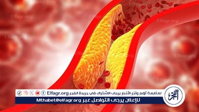 5 أعراض خطيرة تكشف عن ارتفاع الكوليسترول أثناء المشي.. لا تهملها