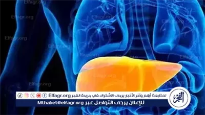 دراسة طبية: الكبد الدهني غير الكحولي يزيد من خطر قصور القلب
