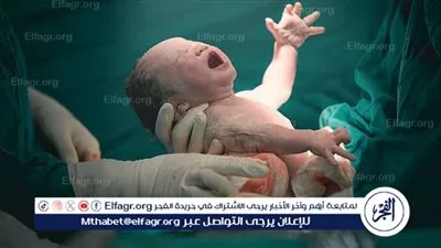 أستاذة أمراض نساء: نسبة الولادات القيصرية في مصر ارتفعت بشكل مقلق