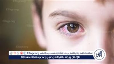 تبخر الدموع والحساسية الموسمية.. استشاري يكشف أبرز أمراض الشتاء التي تصيب العين