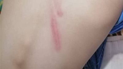 التعليم تتحرك بعد شكوى ولي أمر من اعتداء مدير مدرسة على ابنه