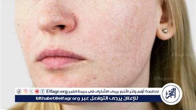 نصائح مهمة للحفاظ على ترطيب البشرة في أجواء الخريف الجافة