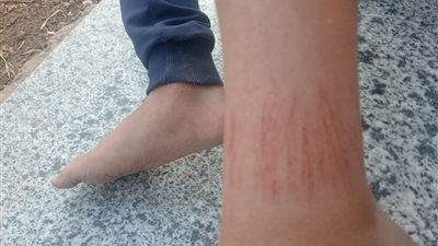 ولية أمر تشكو اعتداء معلمة على نجلها داخل مدرسة بطوخ والتعليم تحقق في الواقعة