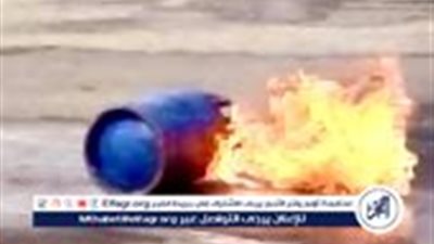  حروق من الدرجة الثانية لـ 