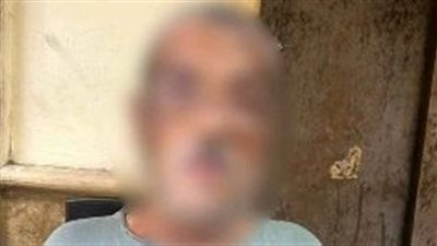 بسبب وضع بضاعة أمام ورشة.. عامل يلقي مادة ك أو ية علي 3 أشخاص بالجمالية 