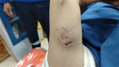 ولية أمر تعتدي بالضرب على مديرة مدرسة بأكتوبر الجديدة