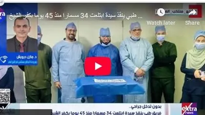 دون تدخل جراحي.. فريق طبي ينقذ سيدة ابتلعت 34 مسمارا منذ 45 يوما(فيديو)