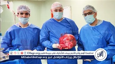 فريق طبي بمستشفى التأمين الصحي ببني سويف ينجح في استئصال ورم سرطاني ضخم