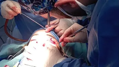 الفريق الطبي بمستشفى تمي الأمديد ينقذ حياة شاب من إصابات بالغة في الرأس والوجه