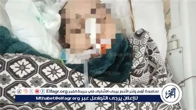 وفاة نورا يحيى بالمنيا بعد صراع 5 سنوات مع التصلب الجانبي الضموري