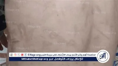 تعذيب طفل على يد زوجة الأب لمدة خمس سنوات بالفيوم