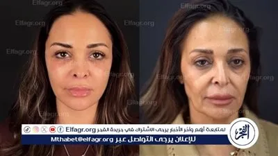 بملامح أكثر شبابًا وإشراقة لافتة.. داليا البحيري تكشف سر إطلالتها الجديدة بعد شد الوجه والرقبة