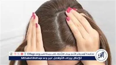 خطوات بسيطة للتخلص من قشرة الرأس والحفاظ على شعر صحي